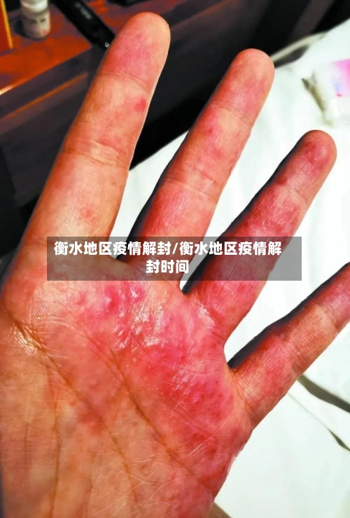 衡水地区疫情解封/衡水地区疫情解封时间