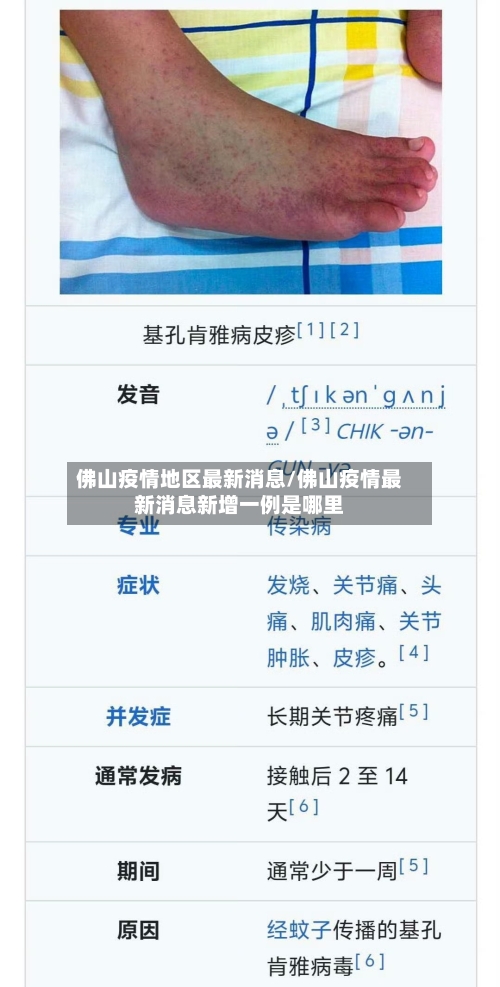 佛山疫情地区最新消息/佛山疫情最新消息新增一例是哪里-第3张图片